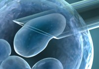 IVF IVF