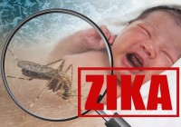 zika-virus--airdone zika-virus--airdone